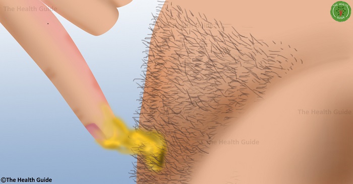 impressive-this-is-how-you-can-remove-body-hair-permanently-no-need-to-wax-or-shave