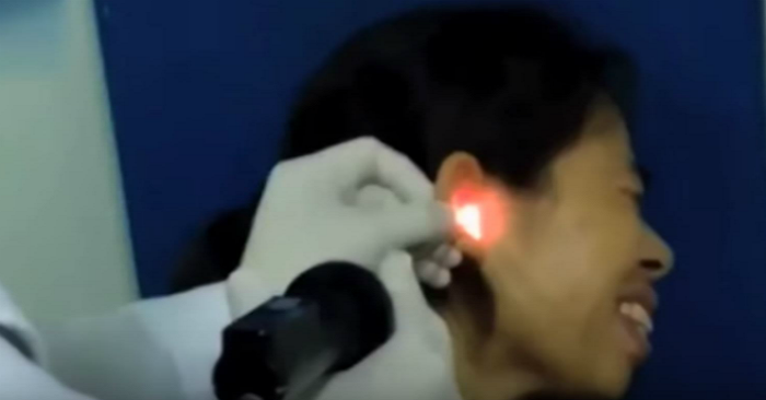 cockroach-ear-1