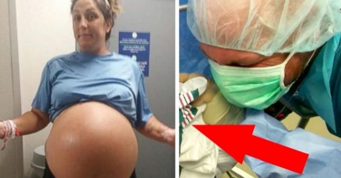 Mammans enorma mage slutar aldrig att växa. Fram tills läkaren utför ett kejsarsnitt! Mammans enorma mage slutar aldrig att växa. Fram tills läkaren utför ett kejsarsnitt!