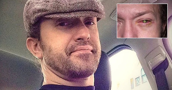 Chad blev blind på grund av ett enkelt misstag som många av oss gör! Chad blev blind på grund av ett enkelt misstag som många av oss gör!
